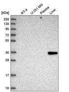 Western blot analysis in human cell line RT-4, human cell line U-251 MG, human plasma and human liver tissue.
