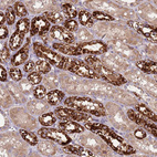 Immunohistochemical staining of human kidney shows strong granular cytoplasmic positivity in cells in distal tubules.