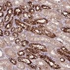 Immunohistochemical staining of human kidney shows strong granular cytoplasmic positivity in cells in distal tubules.