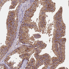 Anti-FECH Antibody