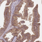 Immunohistochemical staining of human prostate shows moderate granular cytoplasmic positivity in glandular cells.