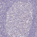 Anti-FECH Antibody