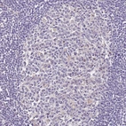Immunohistochemical staining of human lymph node shows no positivity in germinal center cells as expected.