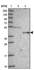 Lane 1: Marker [kDa] 250, 130, 95, 72, 55, 36, 28, 17, 10_br/_Lane 2: Human cell line RT-4_br/_Lane 3: Human cell line U-251MG sp