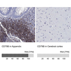 Anti-CD79B Antibody