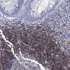 Immunohistochemical staining of human appendix shows high expression.
