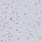 Anti-CD79B Antibody