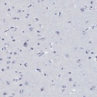Immunohistochemical staining of human cerebral cortex shows low expression as expected.