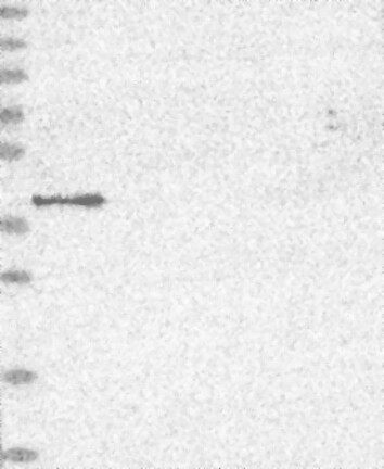 Anti-MVK Antibody