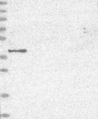 Anti-MVK Antibody
