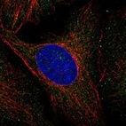 Immunofluorescent staining of human cell line U-2 OS shows localization to cytosol & vesicles.