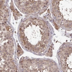 Immunohistochemical staining of human testis shows moderate cytoplasmic positivity in cells in seminiferous ducts.