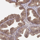 Immunohistochemical staining of human prostate shows moderate cytoplasmic positivity in glandular cells.