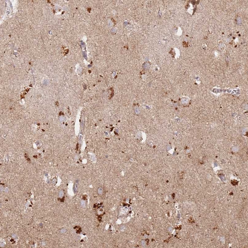 Anti-RIMBP2 Antibody