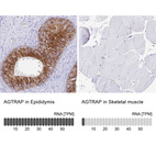 Anti-AGTRAP Antibody