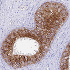 Immunohistochemical staining of human Epididymis shows strong cytoplasmic positivity in glandular cells.