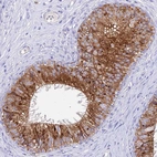 Immunohistochemical staining of human Epididymis shows strong cytoplasmic positivity in glandular cells.