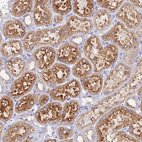 Immunohistochemical staining of human Kidney shows strong cytoplasmic positivity in cells in tubules.