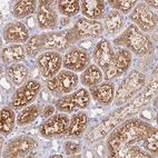Immunohistochemical staining of human Kidney shows strong cytoplasmic positivity in cells in tubules.
