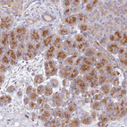 Immunohistochemical staining of human Pancreas shows moderate cytoplasmic positivity in exocrine glandular cells.