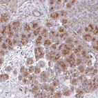 Immunohistochemical staining of human Pancreas shows moderate cytoplasmic positivity in exocrine glandular cells.
