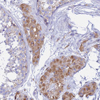 Immunohistochemical staining of human Testis shows moderate cytoplasmic positivity in Leydig cells.