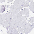 Immunohistochemical staining of human Skeletal muscle shows no positivity in myocytes as expected.