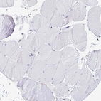 Immunohistochemical staining of human Skeletal muscle shows no positivity in myocytes as expected.