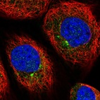 Immunofluorescent staining of human cell line A-431 shows positivity in vesicles.