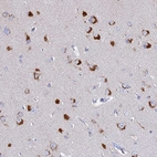 Anti-VTI1B Antibody