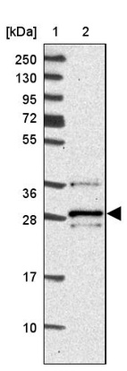 Lane 1: Marker [kDa] 250, 130, 95, 72, 55, 36, 28, 17, 10_br/_Lane 2: Human cell line RT-4