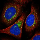 Immunofluorescent staining of human cell line U-2 OS shows localization to the Golgi apparatus & vesicles.