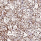 Anti-MOB4 Antibody