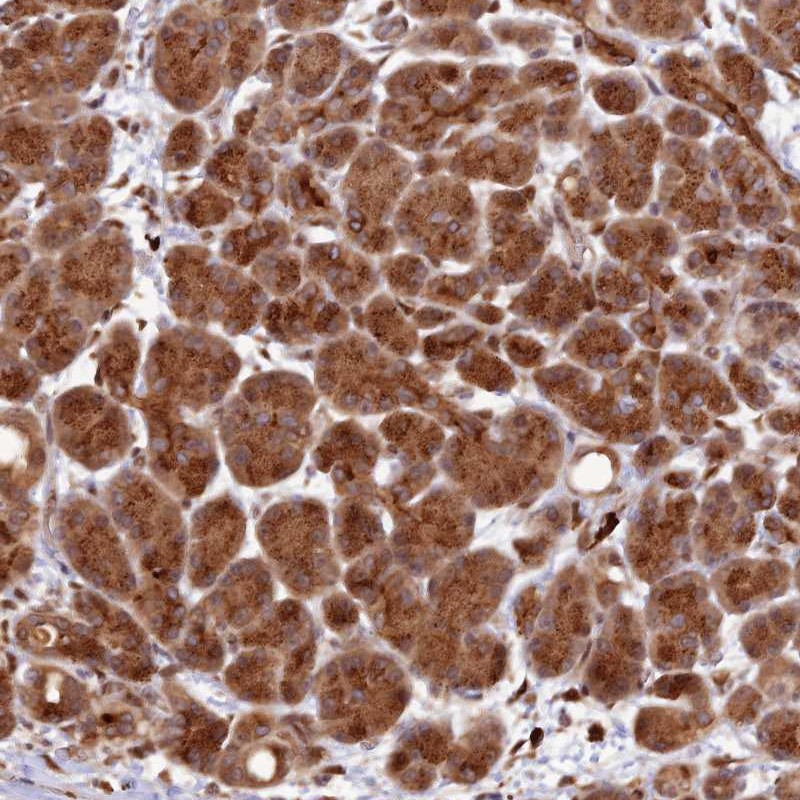 Anti-ZNF565 Antibody