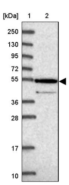 Lane 1: Marker [kDa] 250, 130, 95, 72, 55, 36, 28, 17, 10_br/_Lane 2: Human cell line RT-4