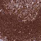 Anti-ABI3BP Antibody