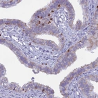Immunohistochemical staining of human fallopian tube shows weak cytoplasmic positivity in glandular cells.