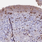 Immunohistochemical staining of human urinary bladder shows moderate cytoplasmic positivity in urothelial cells.