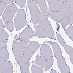 Immunohistochemical staining of human skeletal muscle shows no positivity in myocytes as expected.