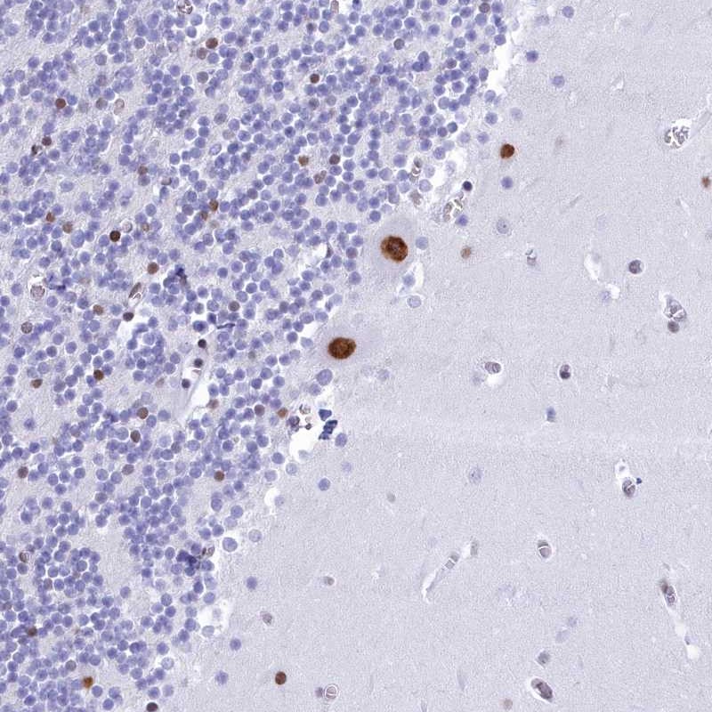 Anti-CDC26 Antibody