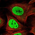 Immunofluorescent staining of human cell line U-2 OS shows localization to nucleoplasm.