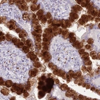 Anti-DHDH Antibody