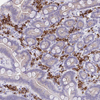 Immunohistochemical staining of human duodenum shows strong cytoplasmic positivity in lymphoid cells.