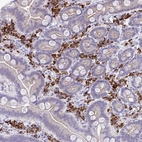 Immunohistochemical staining of human duodenum shows strong cytoplasmic positivity in lymphoid cells.