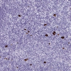 Immunohistochemical staining of human tonsil shows strong cytoplasmic positivity in lymphoid cells.
