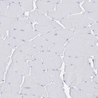Immunohistochemical staining of human skeletal muscle shows no positivity in myocytes as expected.