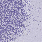 Immunohistochemical staining of human cerebellum shows no positivity in Purkinje cells as expected.