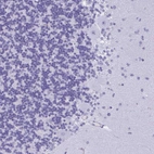 Immunohistochemical staining of human cerebellum shows no positivity in Purkinje cells as expected.