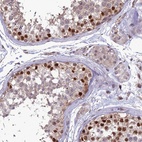 Anti-TSPYL2 Antibody