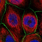Immunofluorescent staining of human cell line CACO-2 shows localization to cell junctions.